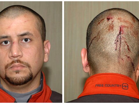 George Zimmerman