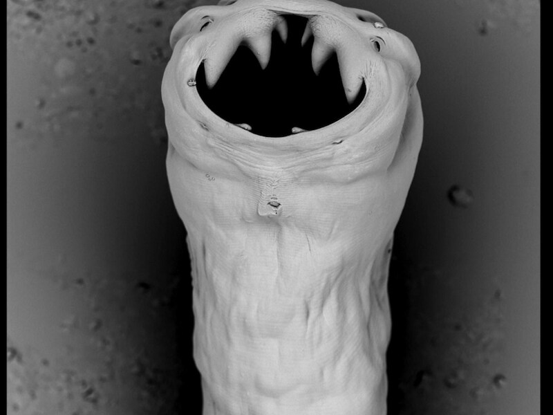 Necator americanus