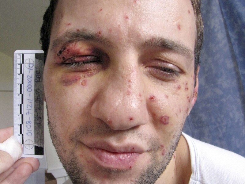 Lors Doukaev. (Foto uit 2010).