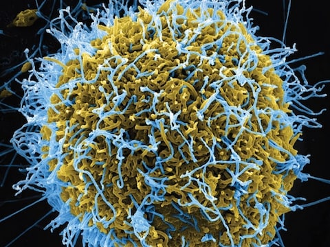 Scan van het ebolavirus uit een geïnfecteerde cel.