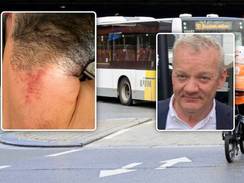 Vier busreizigers proberen controleur van De Lijn te wurgen in Berchem, vakbond reageert fors: “Dit is een poging tot moord”