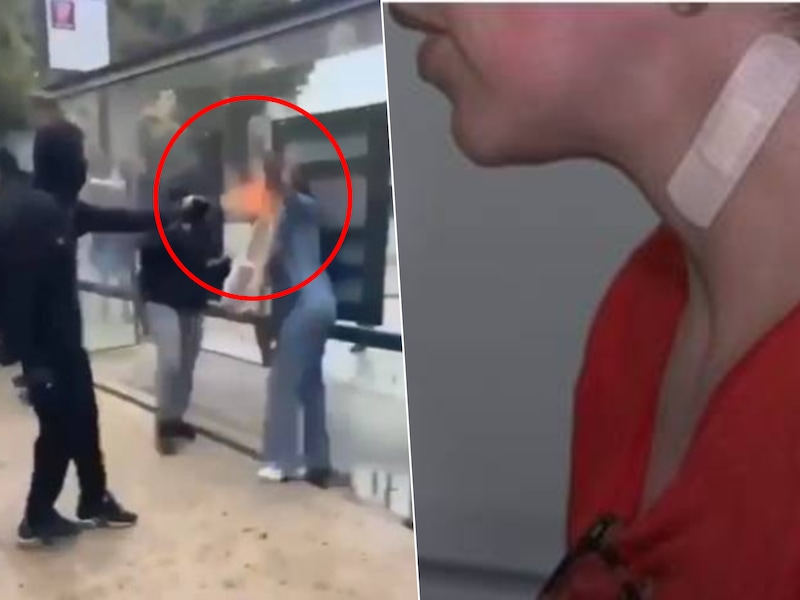 Het moment dat de vrouw in Marseille wordt aangevallen in haar gezicht / De Française tijdens haar getuigenis bij BFMTV