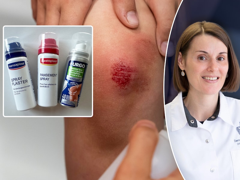 Pleisters nu ook in sprayvorm, maar beschermen die even goed? Dermatoloog: “Voor sommige wonden is het veel handiger”