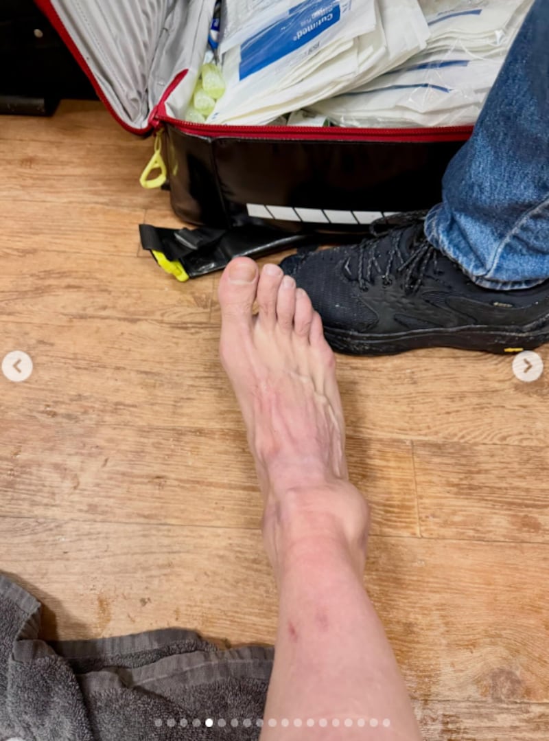 El tobillo de Van Aert tras la caída