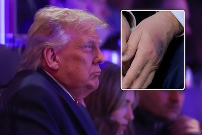 Trump werd tijdens gezondheidscheck onderzocht doo