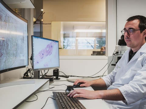 Een patholoog bestudeert in het lab anatome pathologie van ZAS Ziekenhuizen een ingescande tumor. Artificiële intelligentie ondersteunt daarbij.  