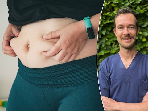 Cardioloog Jan Van Keer (foto) en onderzoekster Camilla van der Hoef leggen uit waarom de BMI niet altijd het juiste beeld geeft. 