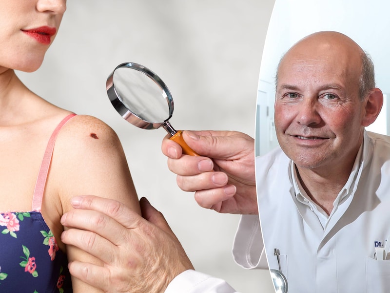 Is nieuw vaccin tegen agressieve huidkanker echt een gamechanger? “Voor gevorderd melanoom zeer beloftevol”