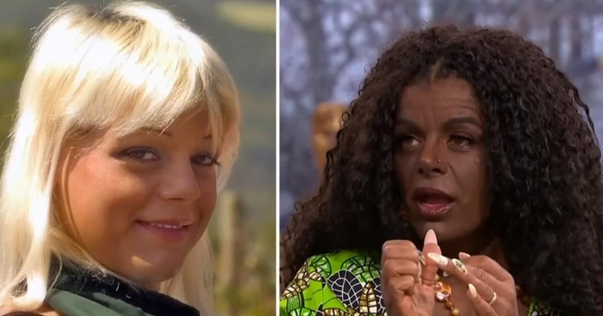 botched melanotan Stunning Transformation of Martina Big Blank model pronkt met haar