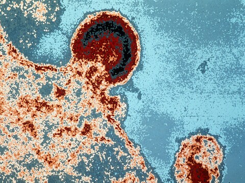 De techniek bestaat erin de reservoirs te ontmaskeren die het HIIV-virus in slapende immuuncellen vormt, waardoor ze naar het oppervlak van de cellen komt. Daar zou het natuurlijke immuunsysteem het virus kunnen elimineren.