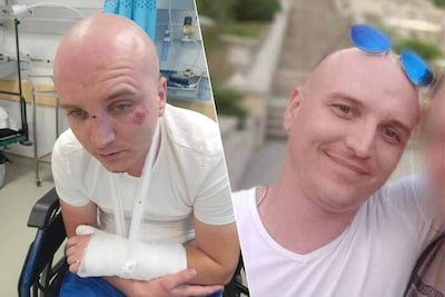 Dmitry (31) brutaal overvallen in Moldavische hoofdstad Chisinau: “Daders nog altijd niet gevat, het lijkt wel of het onderzoek wordt gedwarsboomd”