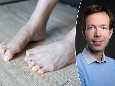 Professor dermatologie Reinhart Speeckaert: “Mensen die minder wegen, hebben een minder goede isolatie tegen de kou.”
