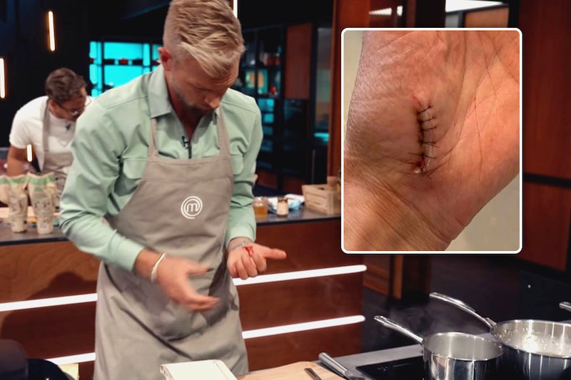 Niet voor gevoelige kijkers: kookavontuur Ruben Van Gucht aan zijden  draadje na diepe snijwonde in 'Celebrity MasterChef' | Showbizz | HLN.be