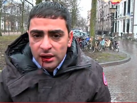 Verslaggever Danny Ghosen hield aan de mishandeling een losse tand, pijn in zijn kaak en een bloedende lip over.