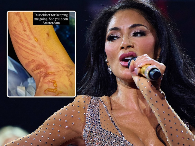 Nicole Scherzinger.