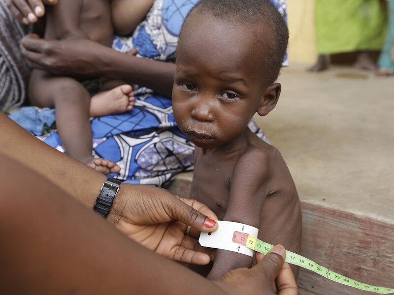 Dokters doen wat ze kunnen voor de overlevenden in het vluchtelingenkamp in Yola. Ook dit zwaar ondervoede kindje kan hun hulp gebruiken.