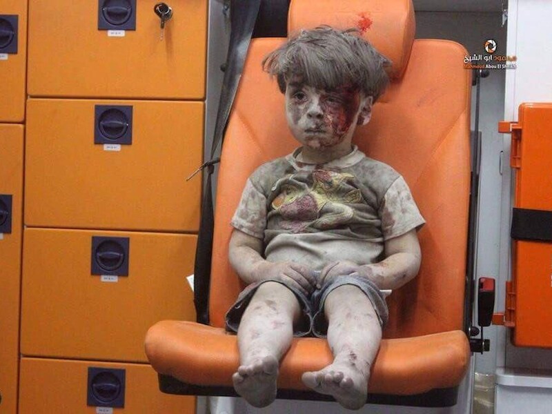 Omran Daqneesh zit in shock in de ambulance nadat hij gewond raakte bij een luchtaanval in Aleppo.