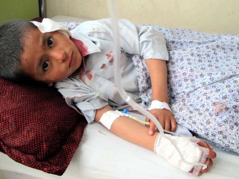 Een gewonde jongen wordt verzorgd na een aanslag in Kunduz dit weekend, die zeker acht burgers doodde en er 18 verwondde.