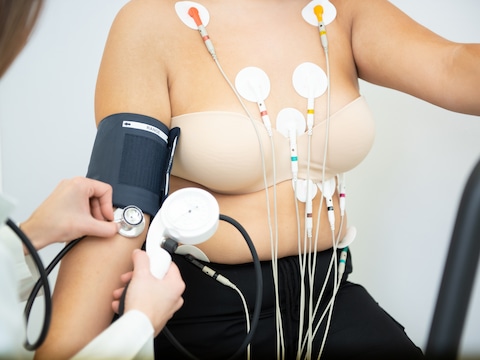 Een cardiale screening bij ZAS toont een hoog risico bij één op vier borstkankerpatiënten.