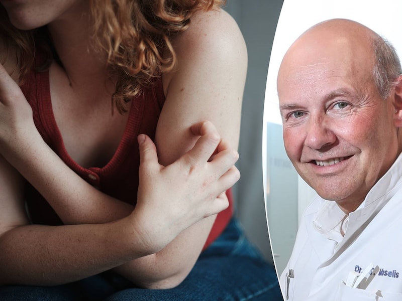 4 op de 10 Belgen hebben keratosis pilaris of ‘strawberry skin’. Dermatoloog geeft tips tegen kleine rode bultjes