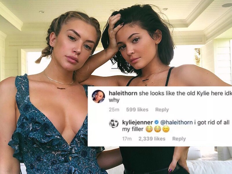 Kylie Jenner zonder lipfillers.