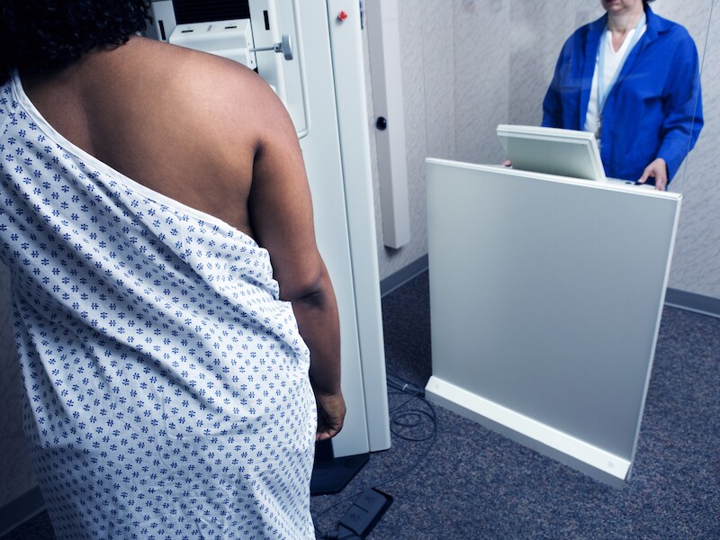 Vrouw ondergaat een mammogram.
