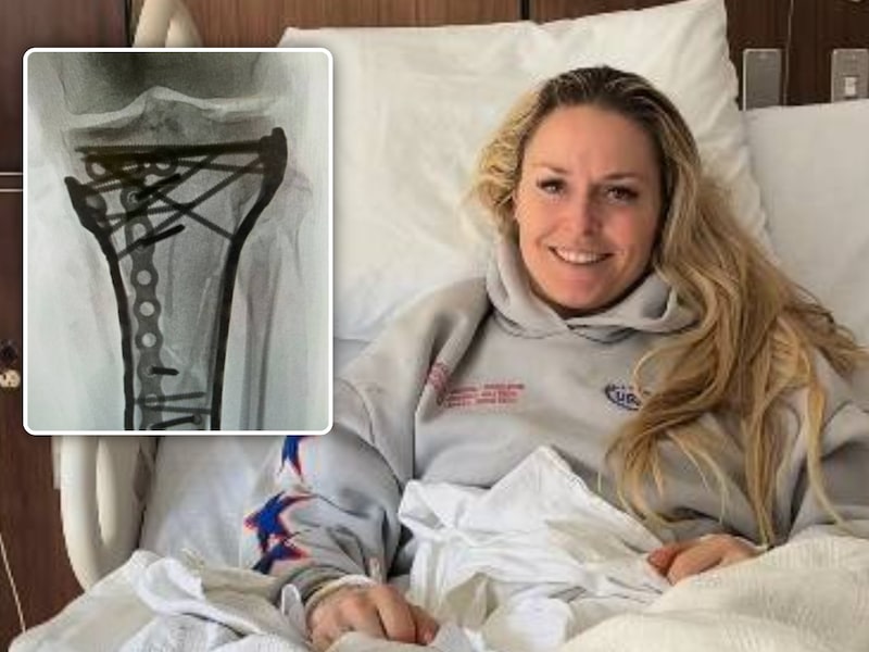 Na dramatische val op Winterspelen blijft lijdensweg duren: skilegende Lindsey Vonn moest nog eens zes uur onder het mes