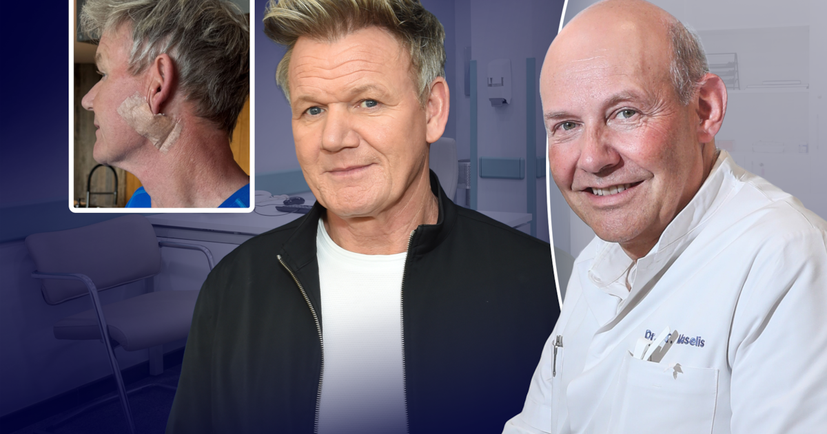“De gevaarlijkste ziet er wat uit als een moedervlek”: hoe herken je ...
