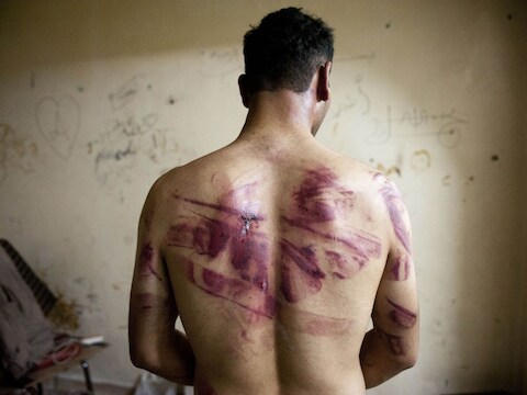 Er wordt ook niet alleen gemoord in Syrië, er wordt ook gefolterd en verminkt.