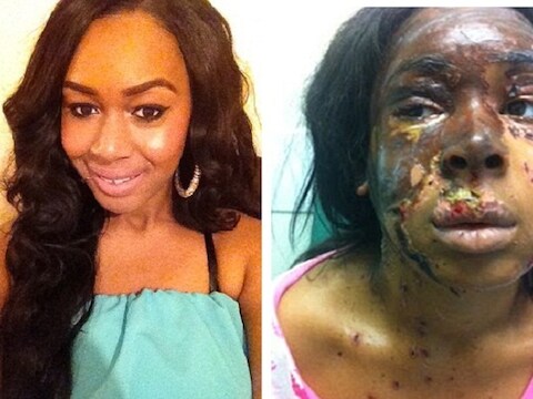 Naomi Oni (20) voor en na de barbaarse aanval.