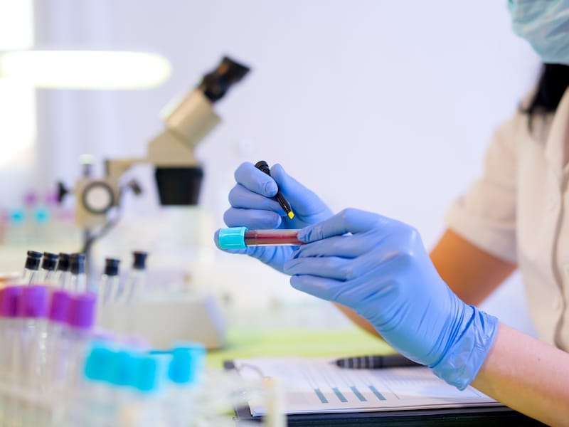 Doorbraak in onderzoek naar pancreaskanker dankzij studie VUB