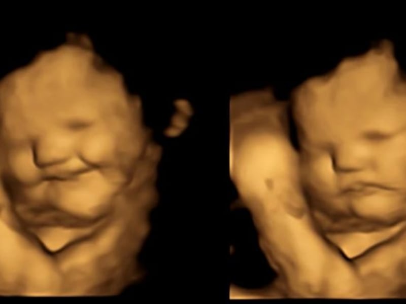 
Smaak van boerenkool doet ongeboren baby’s grimassen trekken