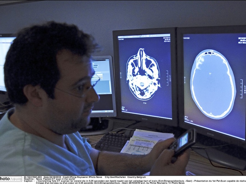 Met behulp van CT-scans werd een symmetrisch 3D-model van de schedel geprint.