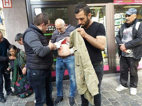 Bebloede slachtoffers na de rellen aan de Turkse ambassade.