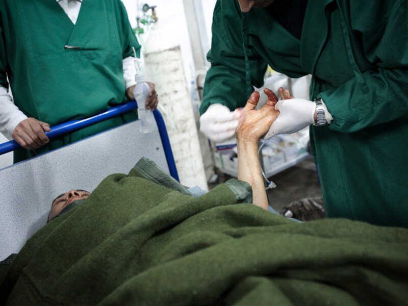 Artsen reinigen de hand van een man die gewond is geraakt door Kadhafi's raketten.