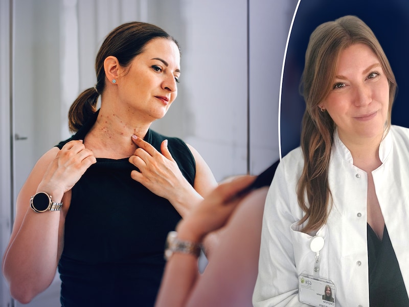 Wanneer moet je pigmentvlekken laten nakijken? Dermatoloog geeft 5 tips: “Niet elke huidkanker ziet eruit als een klassieke bruine of zwarte vlek”
