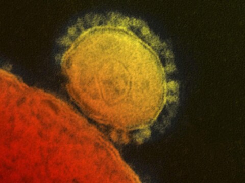 Een microscopische weergave van het MERS-virus, gepubliceerd door het Amerikaanse instituut voor infectieziekten.