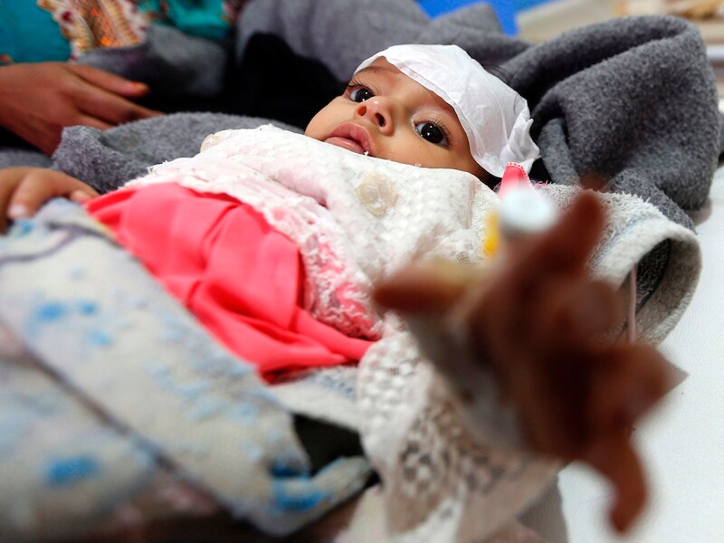 Kinderen en ouderen zijn de grootste slachtoffers van de hongersnood en de cholera-epidemie, twee zware gevolgen van een onophoudelijke burgeroorlog.