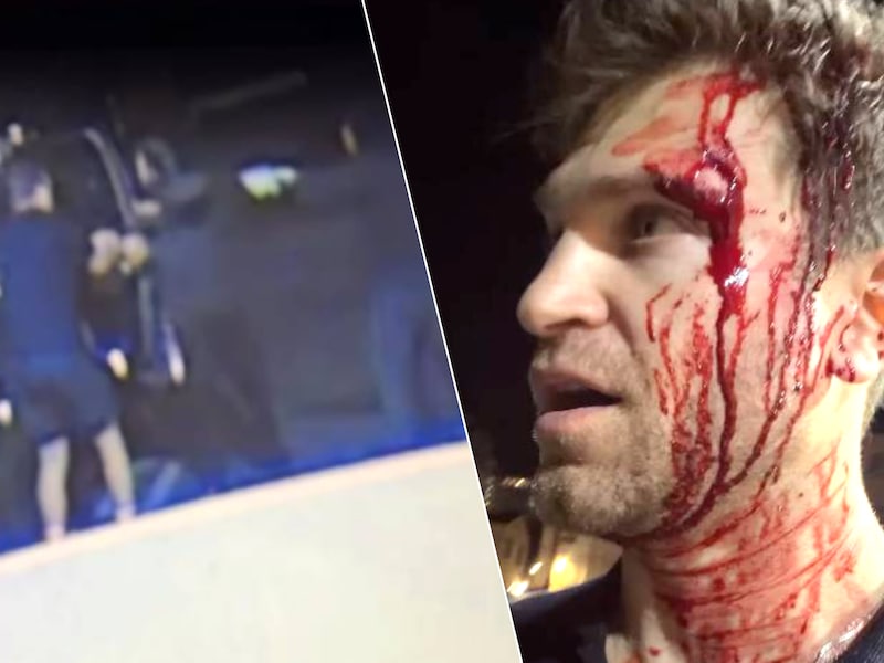 Keegan Allen.