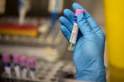 Nederlandse onderzoeker (53) riskeert vijf jaar cel nadat hij apenpokken vanuit Congo de VS binnensmokkelde