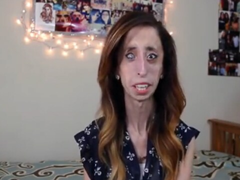 Lizzie Velasquez