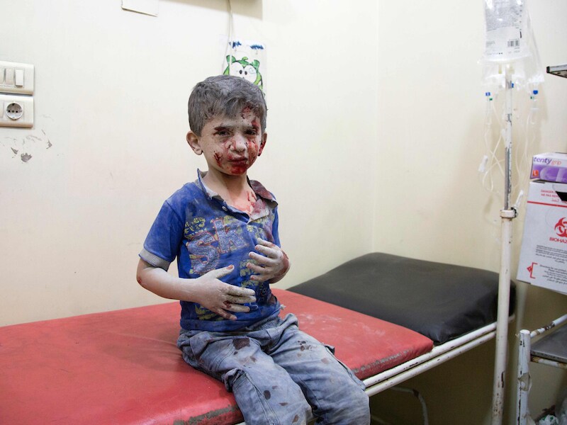 Een Syrisch jongetje wacht op behandeling in een ziekenhuis in het oosten van Aleppo