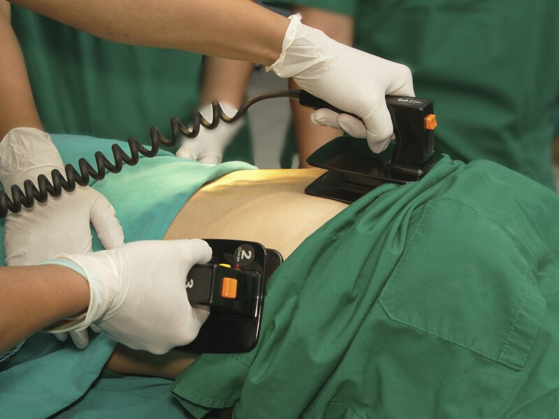 Een defibrillator in actie