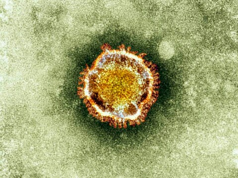 Het Coronavirus onder de microscoop.