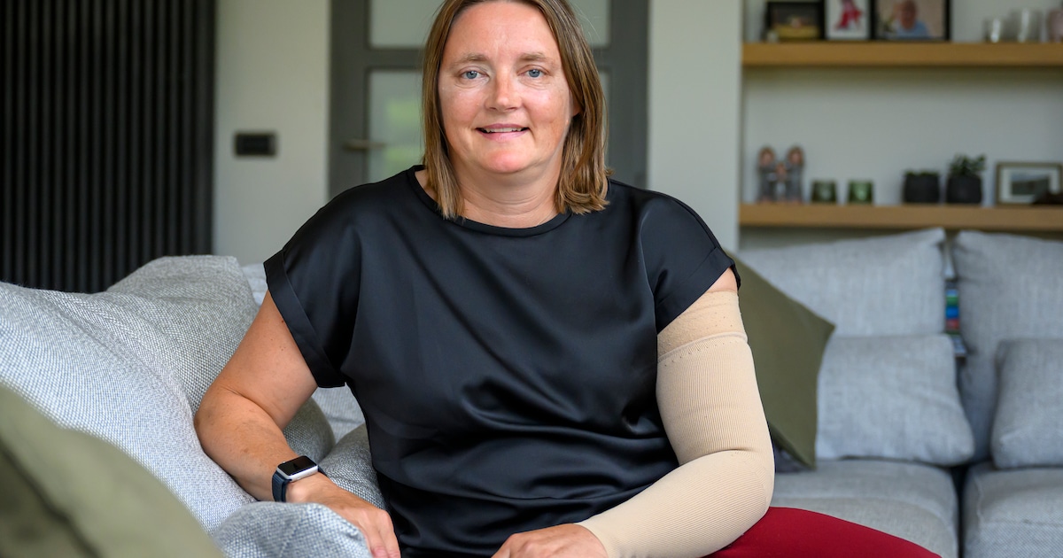 Lymfoedeem maakte Ann leven onmogelijk - innovatieve techniek biedt verlossing: 'Meteen minder pijn!'