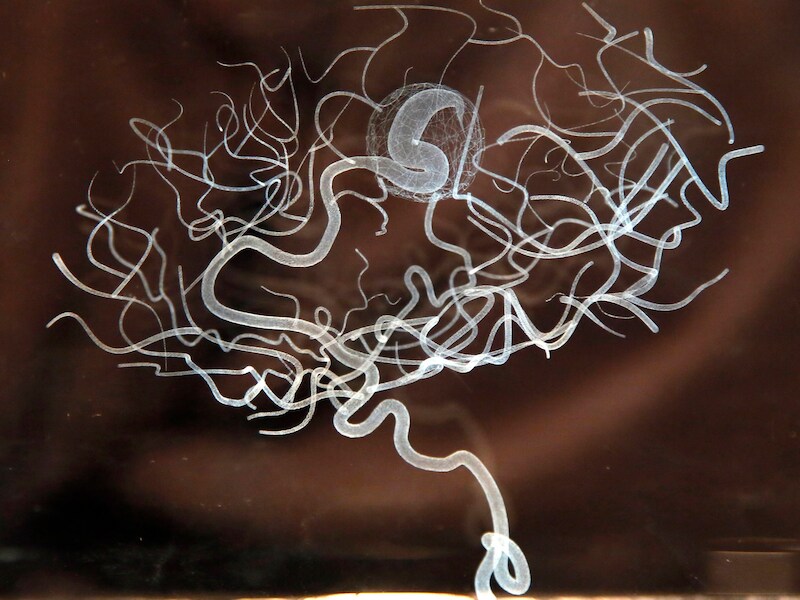 Een kristallen kunstwerk van Katherine Dowson, getiteld 'Memory of a Brain Malformation'.