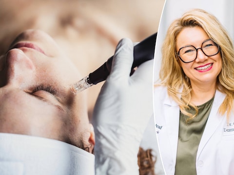 Microneedling is een populaire esthetische behandeling die enkel door artsen mag worden uitgevoerd, maar massaal in schoonheidssalons wordt aangeboden. Zij doen dat onwettig, zegt dermatoloog Dagmar Ostijn.