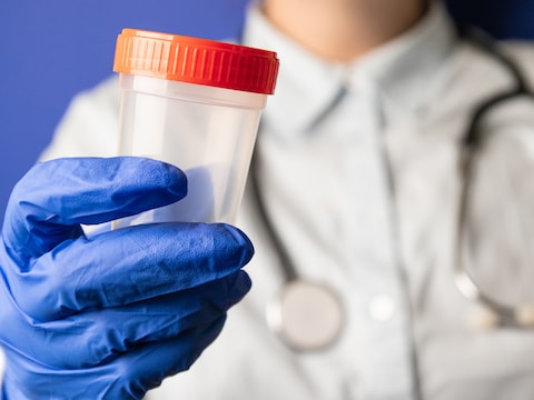 Ook in België werd de wettelijke limiet voor spermadonatie de voorbije jaren voortdurend overtreden.  