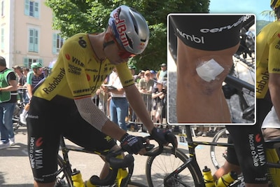 Gehavende Wout van Aert verschijnt aan start met pleisters o