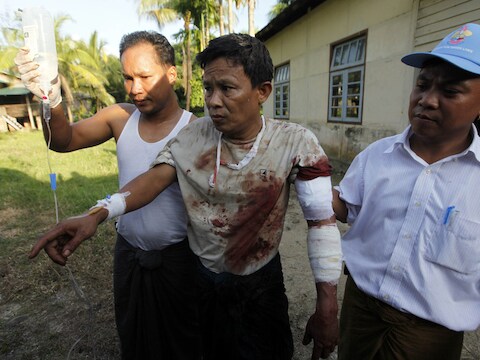 Een slachtoffer van het religieus geweld eerder deze maand in Myanmar.